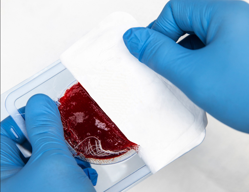 ActiGraft whole-blood clot dressing in its tray